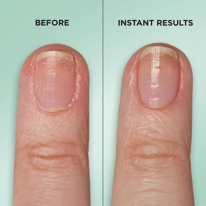 Gel Rehab Nail Repair Serum? - US 6611